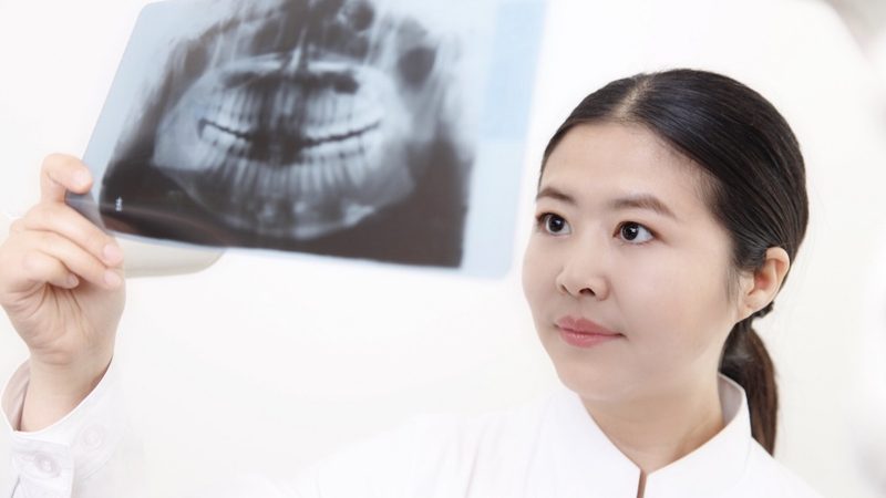 种植牙材质揭秘：如何选择性价比高的材料**