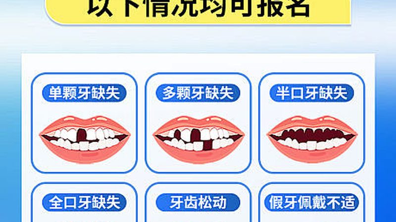 全瓷牙批发加盟，你需要了解这些条件**